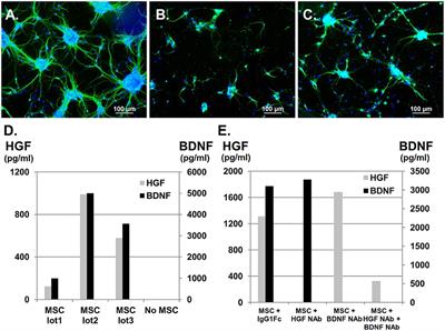 Umbilical Cord-Derived Mesenchymal Stromal Cells Contribute to Neuroprotection in Neonatal Cortical Neurons Damaged by Oxygen-Glucose Deprivation